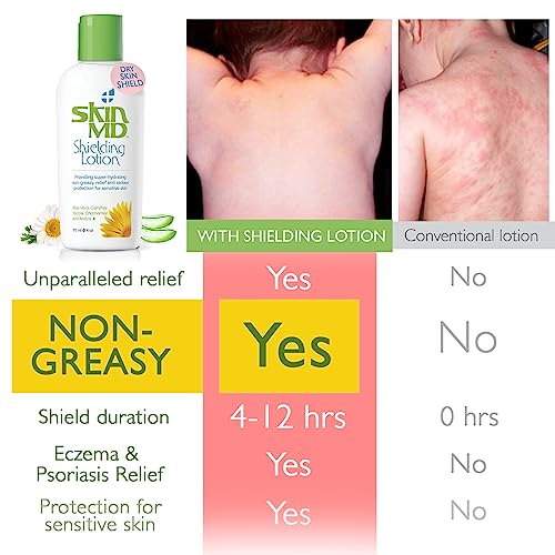 Skin MD Shielding Body Lotion for Sensitive Skin - Hydrating, Non-Greasy, Fast Absorbing 8oz