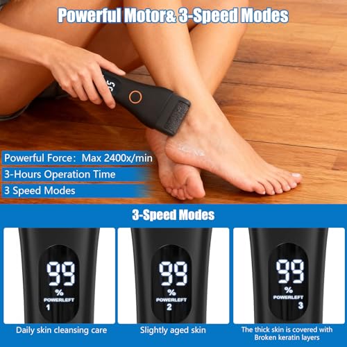 Dermawave Electric Foot File Callus Remover for Feet, Professional Foot Sander Grinder with 60 Sandpaper Discs for Men & Women, Pedicure Tool for Corn Dead Skin Cracked Heel