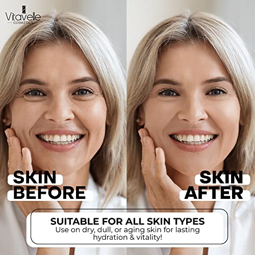 Hyaluronic Acid Serum with Aloe Vera ? Anti Aging Aloe Hyaluronic Acid Face Serum ? Postbiotic Hyaluronic Acid Moisturizer and Hydrating Serum ? No Parabens or Irritants ? Skin Serum by Vitavelle