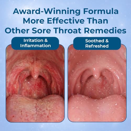 ioRinse STR Mint Sore Throat Relief Gargle - 16.9 Fl Oz, Professional Strength