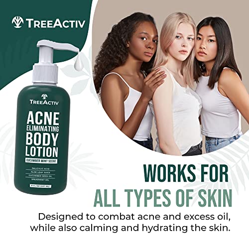 Acne Body Lotion for Clear Skin - Moisturizer with Tea Tree & Cucumber - 8 fl oz