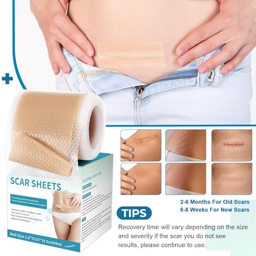Rvlaim Medical-Grade Silicone Scar Sheets 4M Roll for Keloid & Surgical Scars