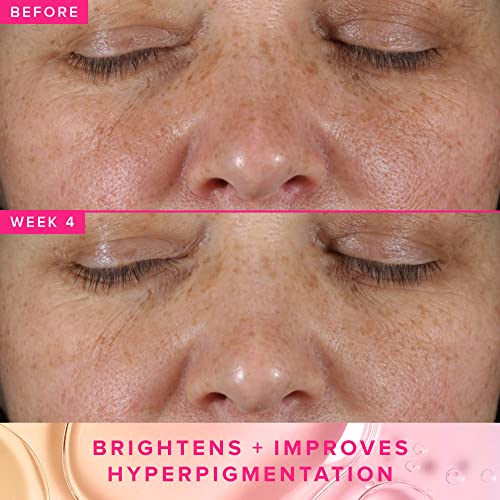 Farmacy 3% TXA Brightening Toner for Face - Dark Spot Corrector with Azelaic Acid, Tranexamic Acid + 5% PHA - Helps Even Texture + Tone, Fade Dark Spots + Exfoliate - Glow-Enhancing Skin Care (120ml)