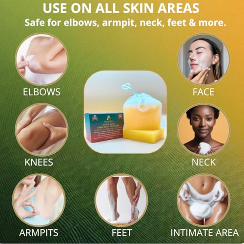 Altobello's Turmeric Kojic Acid Soap - Dark Spots Remover for Face & Body, Brightening Skin Lightening Bar with Vitamin C, Collagen, Hyaluronic Acid - 2 Bars + Exfoliating Net.