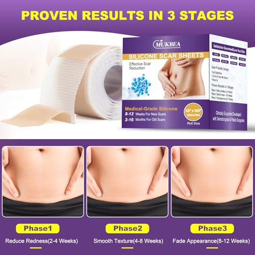 Silicone Scar Sheets, Silicone Scar Tape, Scar Tape for Keloid Bump Removal, Reusable Silicone Scar Strip for C-Section, Keloid, Surgery, Burns, Acne Scar et(1.6¡±x120¡±Roll-3M)
