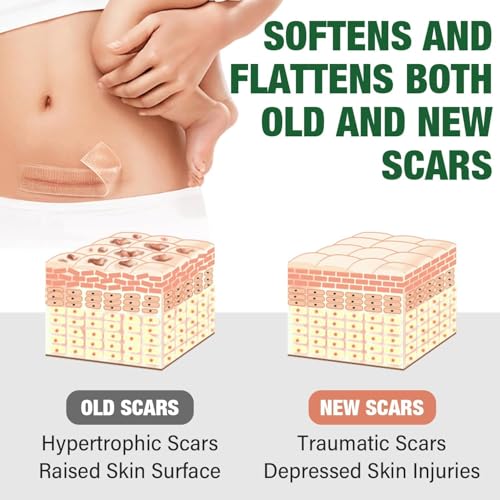 Silicone Scar Sheets,Silicone Scar Tape,Silicone Sheets For Scars,Scar Tape For Surgical Scars,Keloid Bump Removal,Scar Removal For Surgical(1.6"x 60" Roll-1.5M)
