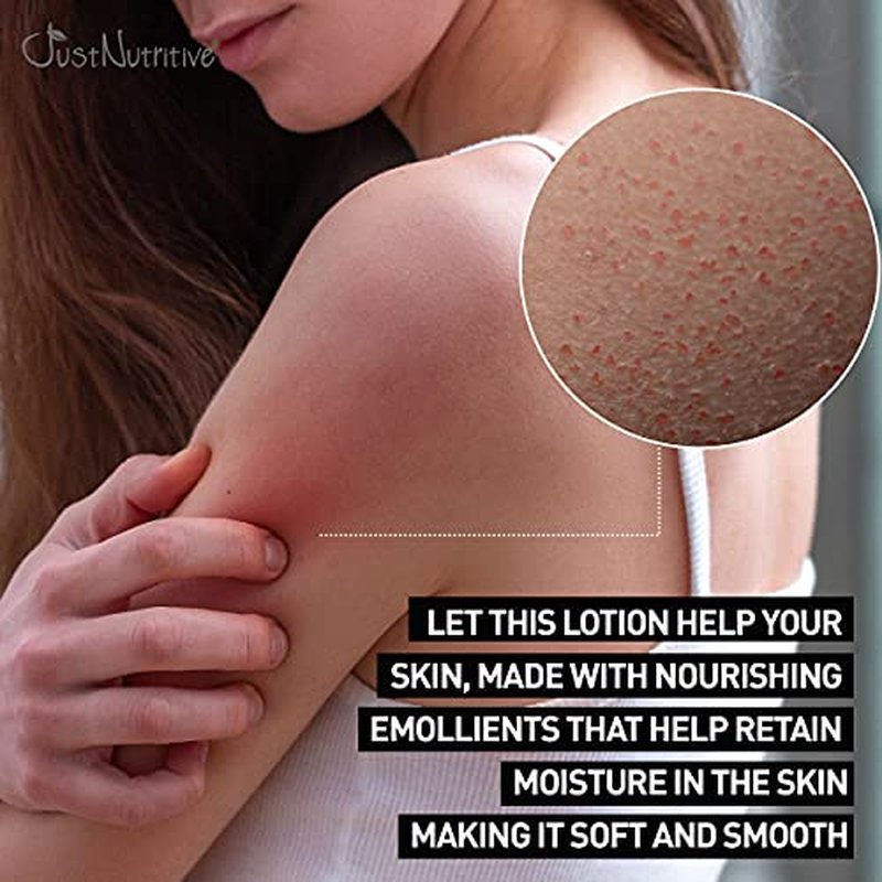 Just Nutritive Rough And Bumpy Skin Lotion | Dry Skin Lotion | Body Lotion | Smoothing Lotion for Dry, Rough Patches and Tiny Bumps | Lotion for Keratosis Pilaris 8 Oz