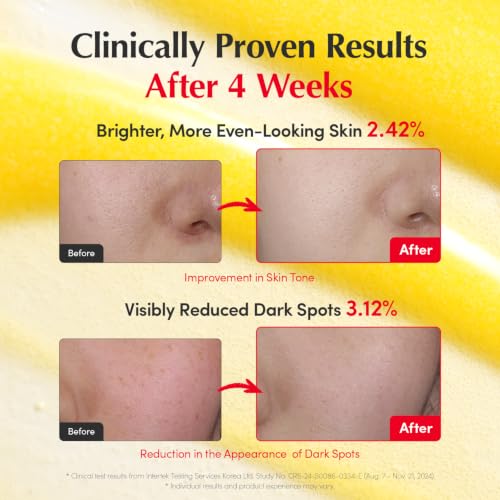 EQQUALBERRY Brightening Vitamin C Serum with Niacinamide & Hyaluronic Acid, 1.01 fl oz - Dark Spot & Uneven Tone Care