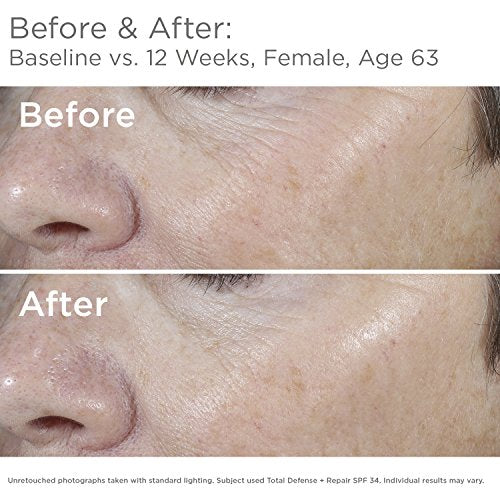 SkinMedica Total Defense + Repair SPF 34 Sunscreen for Face 2.3oz - Broad Spectrum Protection