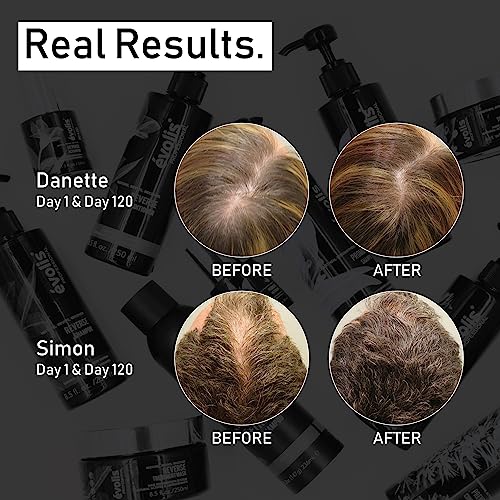 Evolis Promote Nourishing Hair Mask for Dry Damaged Hair 8 Fl Oz - Pack of 1