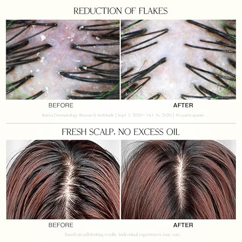 Podoclos Rebalancing Scalp Shampoo - Cooling & Refreshing Hair Care for Sensitive & Oily Scalps, 16.9 fl oz