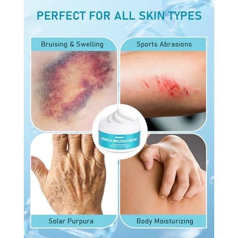 Arnica Bruise Relief Cream Extra Strength: Soothing Moisturizer with Vitamin K, C & E for Thin & Sensitive Skin - Daily Care for Teens, Adults & Mature Skin (3 Oz * 2 PCS)