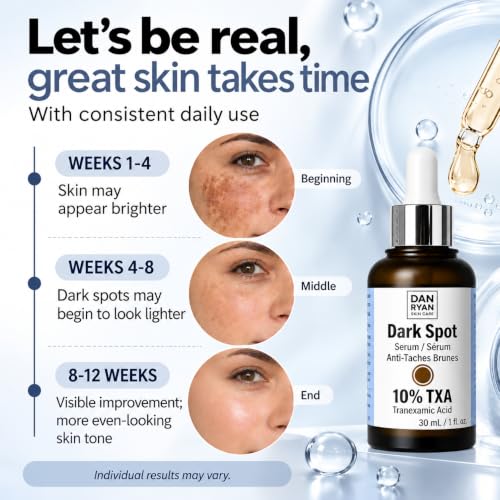 Dark Spot Corrector Serum with 10% Tranexamic Acid & Niacinamide – Brightening Face Serum for Sensitive Skin – 30mL