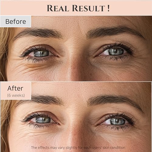 Beauty of Joseon Revive Eye Serum (30ml, 1 fl.oz) + Glow Serum (30ml, 1 fl.oz) Korean Skincare