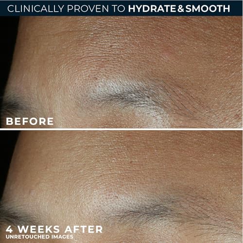 RoC Retinol Correxion Max Daily Hydration Face Moisturizer,