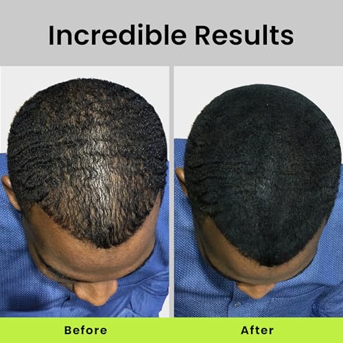 ECLIPSE Hair Fibers Black 30g - Instant Thinning Hair Concealer, Salon Quality