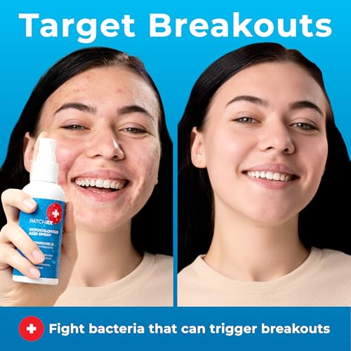 Hypochlorous Acid Spray for Face (8oz, Reduces Acne), Targets Bacteria - HOCL Facial Cleanser Acne Spray for Face, Body, Eczema, Pimples, Breakouts & Overall Skin Recovery (Reduces Redness)