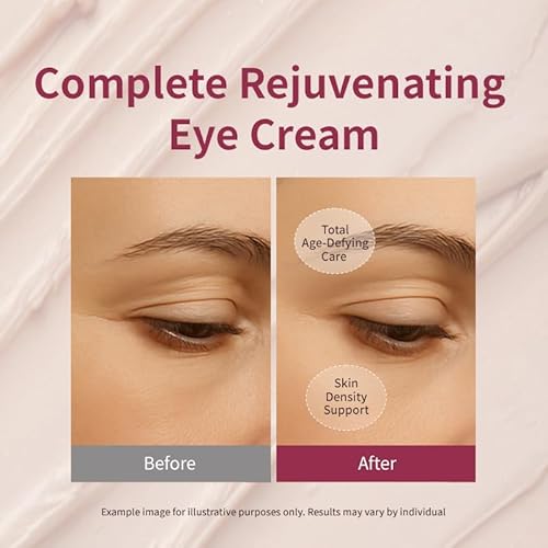 Chogongjin Youngan Jin Eye Cream, Anti-Wrinkle 1.01 fl oz, For All Skin Types