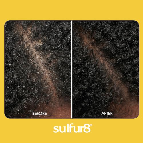 SULFUR8 Medicated Anti-Dandruff Hair & Scalp Conditioner 7.25 oz Pack of 2 - Soothes Itchy Scalp & Moisturizes All Hair Types