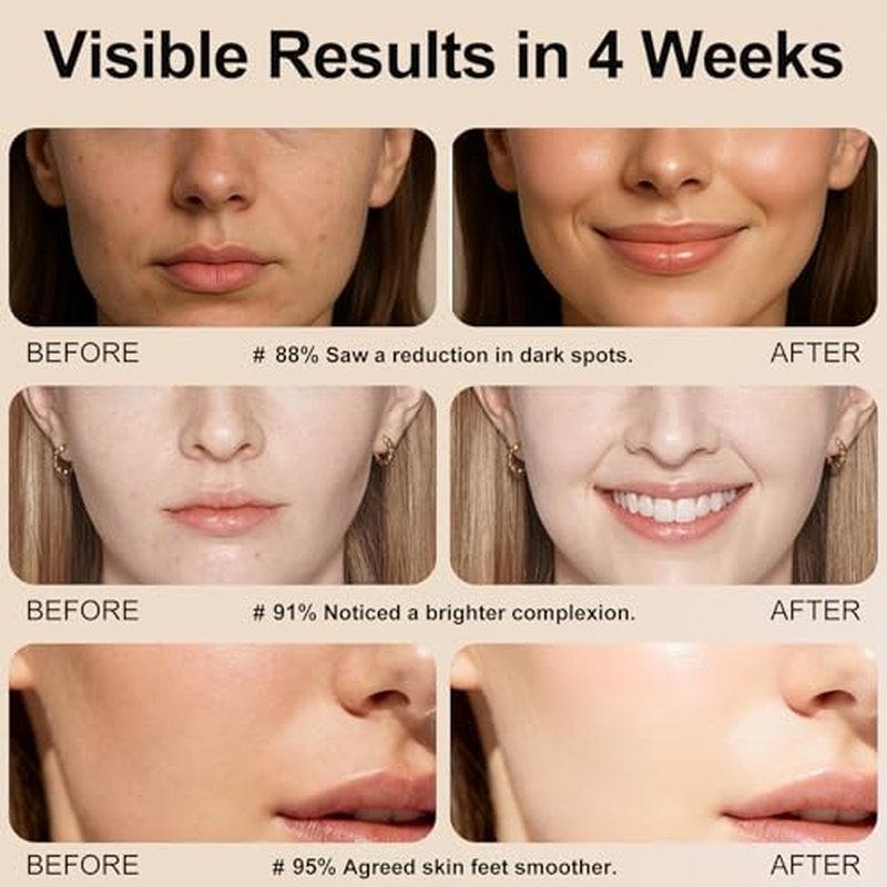Boost Skin Collagen,Hydrate & Plump Skin, Anti Aging & Wrinkle Facial Serum 60ml-5