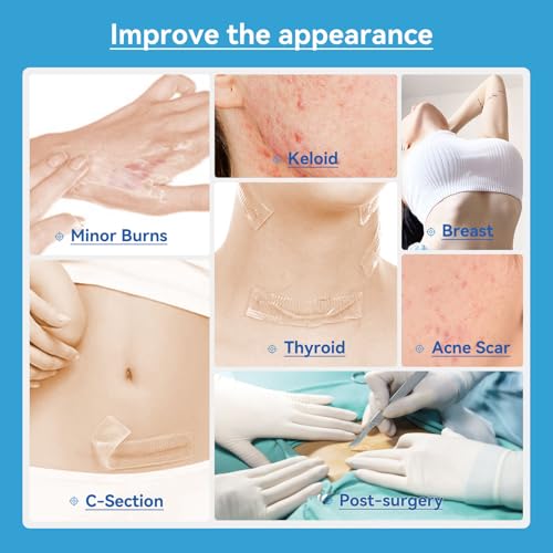 Silicone Scar Sheets Ultra-Thick 1.75mm Trimmable for Old & New Scars