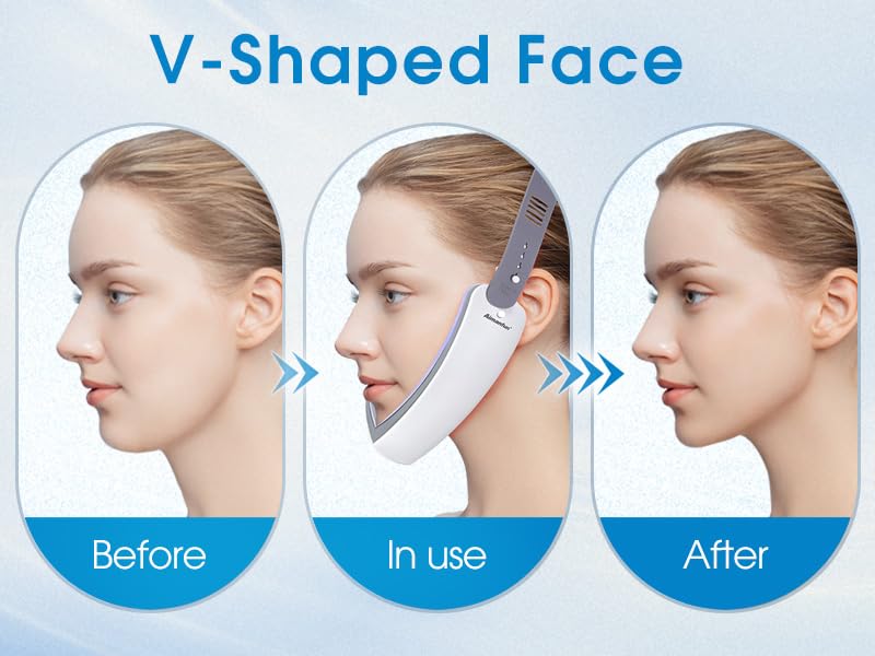 V Face Double Chin Reduction Device with Remote Control for Women