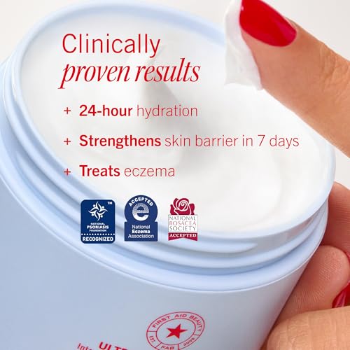 First Aid Beauty - Ultra Repair Cream - Intense Hydration Face & Body Moisturizer - Whipped Colloidal Oatmeal Clinically Proven to Strengthen Skin Barrier in 7 Days - Helps Relieve Eczema, 4 oz