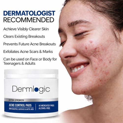 Acne Treatment Pads with Glycolic Lactic Salicylic Acid for Face & Body