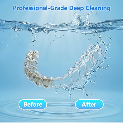 200ml Ultrasonic Retainer Cleaner Machine - White, 48kHz, 4 Modes