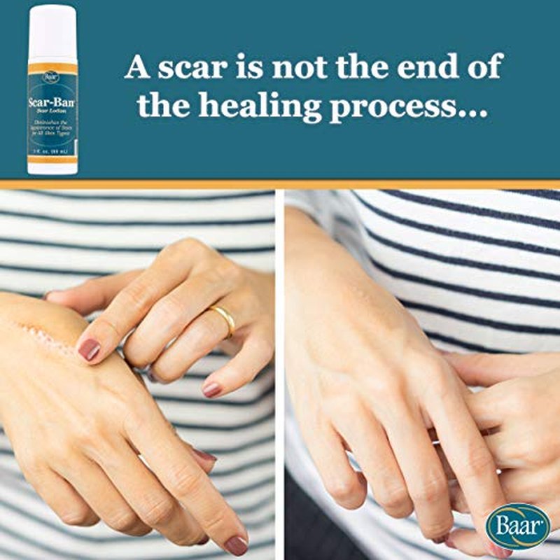 Baar Scar Ban Roll On, 3 oz. (Pack of 2)
