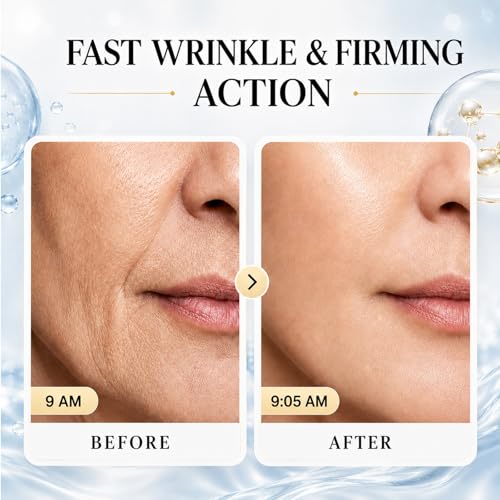 Hydrating Anti-Aging Face Cream with Hyaluronic Acid - 30ML