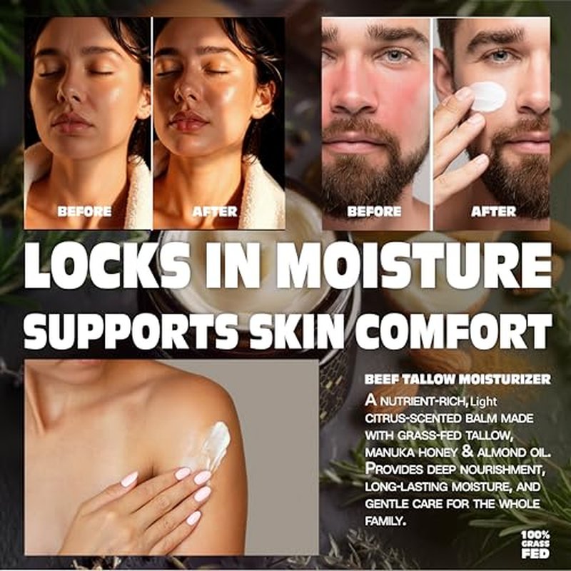 Beef Tallow for Skin ? Face & Body Balm to Strengthen Skin Barrier, Hydrating & Soothing with Grass-Fed Beef Tallow, Manuka Honey, Almond Oil & Light Citrus Scent (3.38oz)