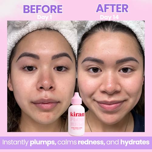 Hydrating Face Serum & Lightweight Moisturizer for All Skin Types - Aloe & Niacinamide - 2 fl oz