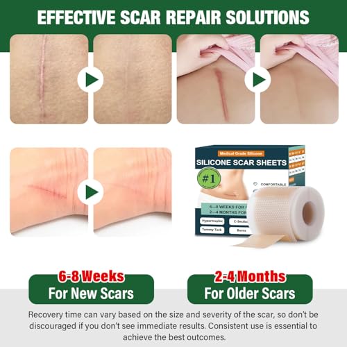 Silicone Scar Sheets,Silicone Scar Tape,Silicone Sheets For Scars,Scar Tape For Surgical Scars,Keloid Bump Removal,Scar Removal For Surgical(1.6"x 60" Roll-1.5M)