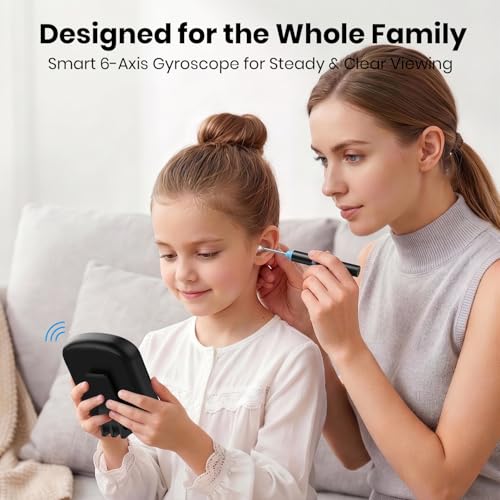 Cklvu Smart Digital Otoscope Ear Camera with 2.8" Screen – Plug & Play, Black (Variation: Black)