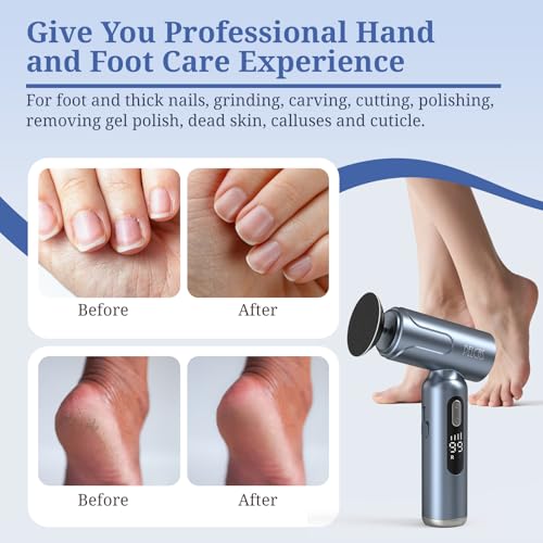 Pelcas Electric Foot Callus Remover with LED Screen, 0-99 Speed, Cordless Foot File for Hard Skin Removal
