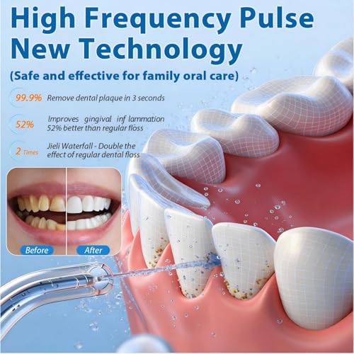 Cordless Water Flosser 300ML Rechargeable Dental Pick for Braces - White