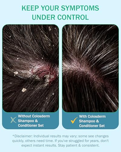 Colosderm Eczema Shampoo & Conditioner for Sensitive Scalp - Kids & Adults, 16 fl oz