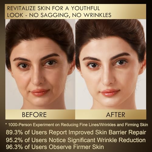 US-Made With 30% Active Ingredients,SGS Certified, Retinol Vitamin C Niacinamide, Ceramide,Oligopeptides,Anti-Aging Face Moisturizer for Face, Firming Skin Care,Neck & Upper Chest -1.7 fl.oz