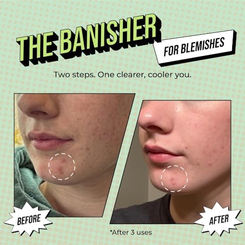 Avatara 2-Step Hydrating & Brightening Sheet Mask Set for Teens - Vegan & Fragrance-Free