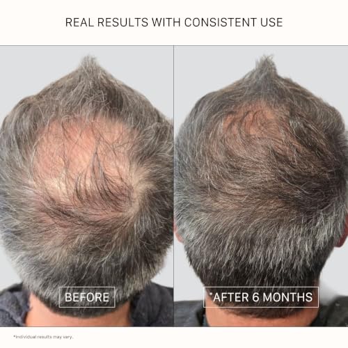 ACTIIV Recover Thickening Conditioner 16 Fl Oz Pack for Fuller Hair - Unisex