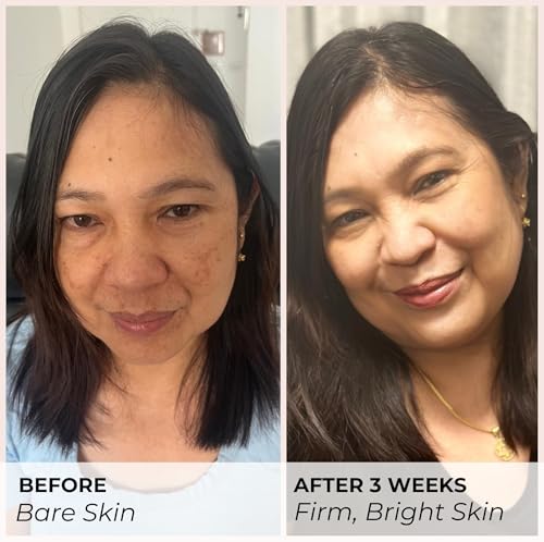 Marine Collagen Face Cream with Hyaluronic Acid & Niacinamide - Anti-Aging Moisturizer for Brightening & Firming - 3.4 fl oz