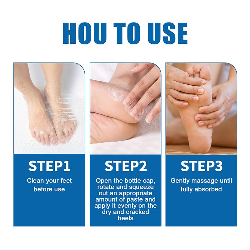 Anti Crack Foot Cream Stick, Crack Feet Prevention Stick, Foot Care Cream Roll On, Dead Skin Removal Moisturizer, Callus Remover For Dry Feet (Blue*2)