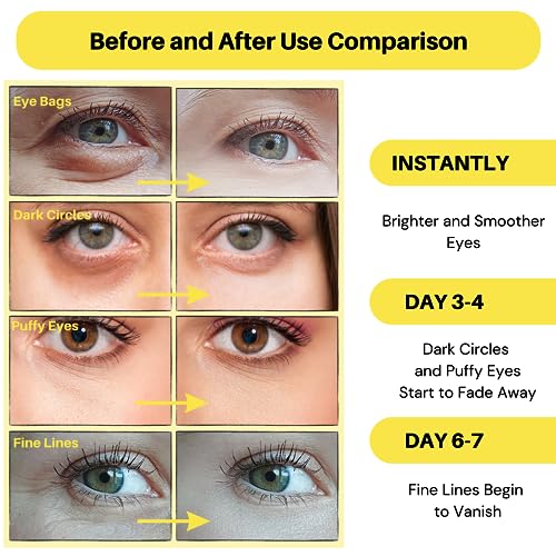 Versed Water Rush Hydrating Eye Gel - Under Eye Cream for Puffiness and Bags Under Eyes - Hyaluronic Acid Under Eye Brightener - Clinically Tested Gel-Cream Formula