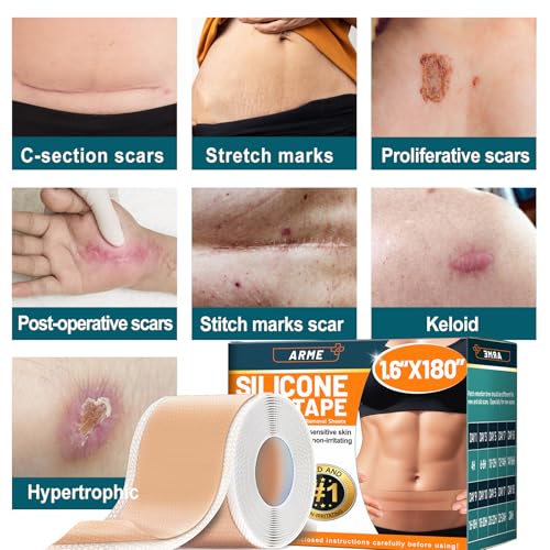 Arme Silicone Scar Tape, Silicone Scar Sheets for Surgical Scars(1.6"x180" Roll-4.6M), Medical Grade Scar Tape Reusable Sheets for Scar Treatment, Soft Scars Tapes for C-Section Keloid Tummy Tuck