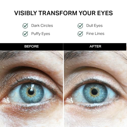 Y¡¯OUR Retinol & Peptide Complex Eye Cream: Anti-Aging for Dark Circles, Puffiness, Wrinkles & Crow¡¯s Feet; Hydrating & Under Eye Repair. Made in USA. Gifts for Women
