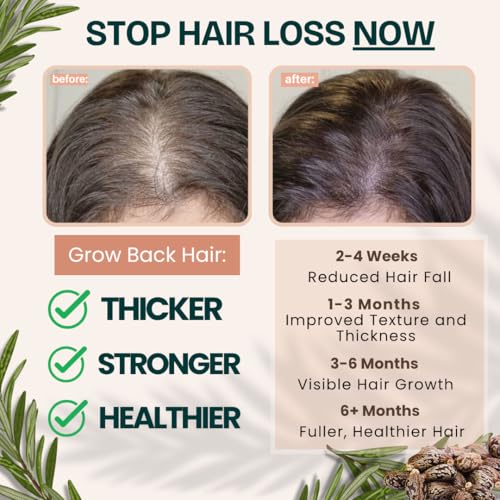 Rosemary Castor Oil for Hair Growth - Glass Bottle 16 Fl Oz - Live Fraiche