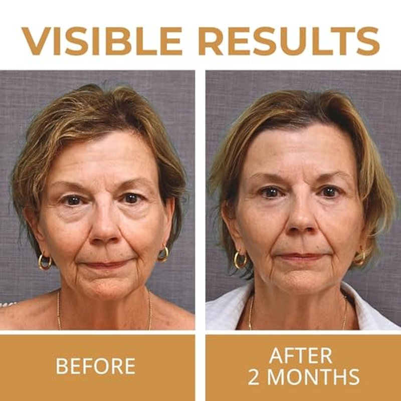 ABERA Natural Repair Eye Cream, Minimizes Under Eye Bags & Puffiness, Reduce Wrinkles, Fine Lines and Dark Circles, 0.5 fl.oz