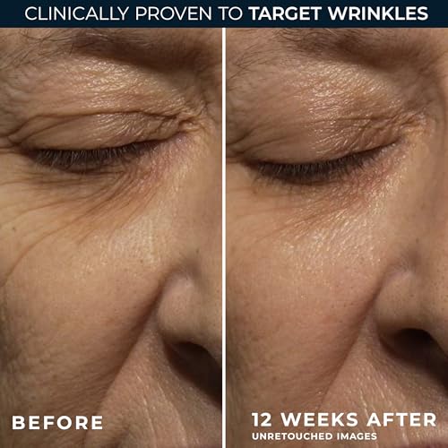 RoC Retinol Correxion Deep Wrinkle Night Cream 0.5oz Pack of 2 – Anti-Aging Face Moisturizer with Shea, Glycolic & Squalane