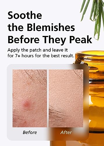 DWEasyDerm Invisible Pimple Patch 42 Count Relief Pack with Tea Tree Oil, Waterproof & Slim